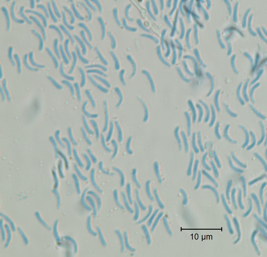 Rhytisma acerinum Figure 3